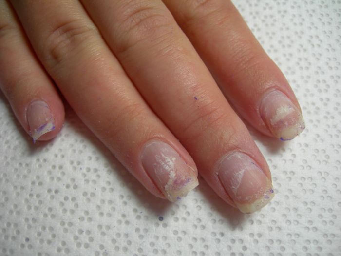 Image result for soft peeling nails