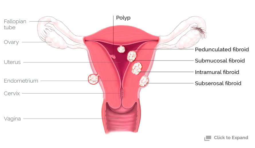 Female Genital I