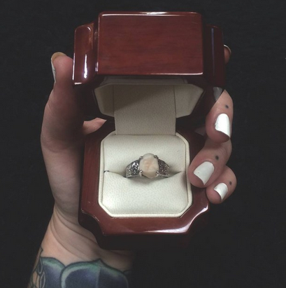 tooth engagement ring