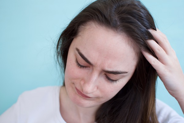 large dandruff flakes