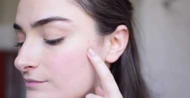 how to lighten pimple scars