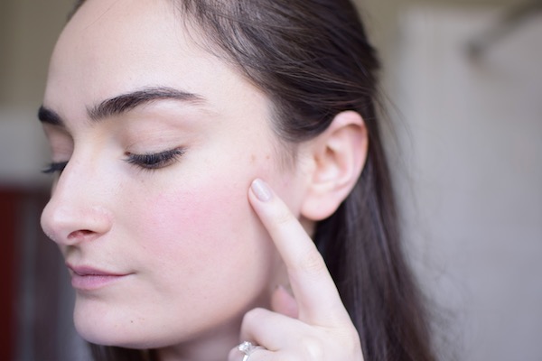 how to lighten pimple scars